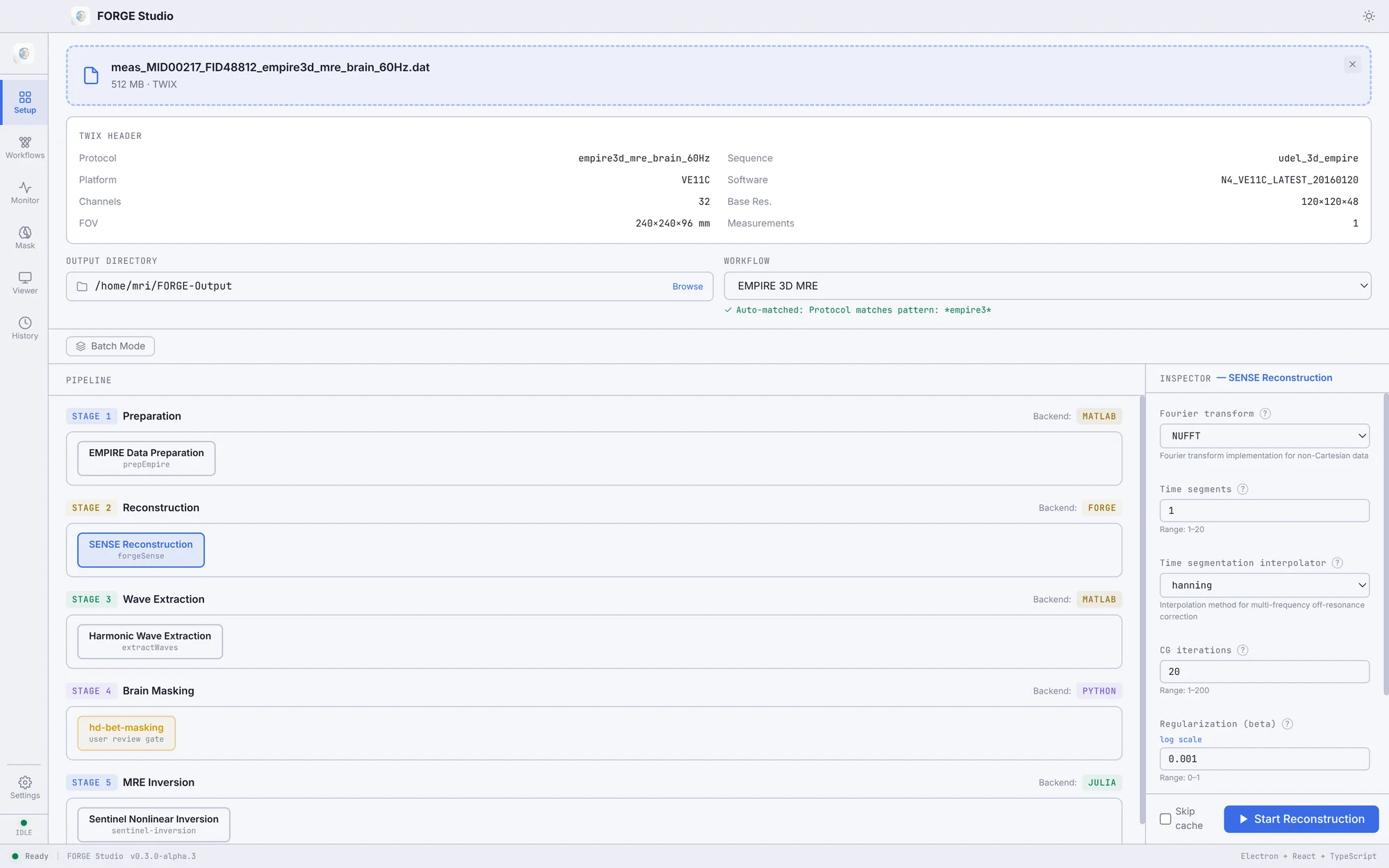 Setup tab with a TWIX file loaded, auto-matched to the EMPIRE 3D MRE workflow, and the SENSE step open in the inspector